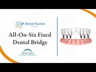 All on Six Fixed Bridge (Full Mouth Dental Implants) Cancun - Dental Tourism Mexico