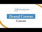 Dental Crowns Cancun