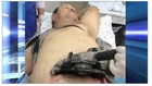 Power Saw Gets Embedded in Man's Stomach